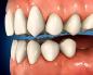 Tessuto osseo dentale: struttura e proprietà
