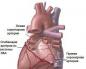 Isquemia cardiaca