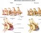 Cambios distróficos degenerativos en la columna lumbar: síntomas y tratamiento Cambios distróficos degenerativos en la columna lumbar