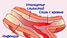 Информация за центрове за кистозна фиброза в Русия
