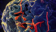 Страшные и опасные болезни человека вызываемые бактериями