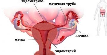 Противозачатъчните хапчета като лек за много заболявания Механизми на действие на оралните контрацептиви