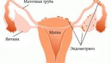 Защо долната част на корема е стегната след менструация?